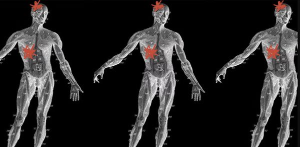 New insights into how liver disease affects the brain